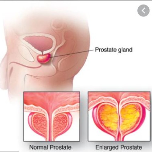 PROSTATE  (Made in USA )