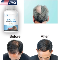Biotin Biotin Advanced Hair Growth Formula (Made in USA)